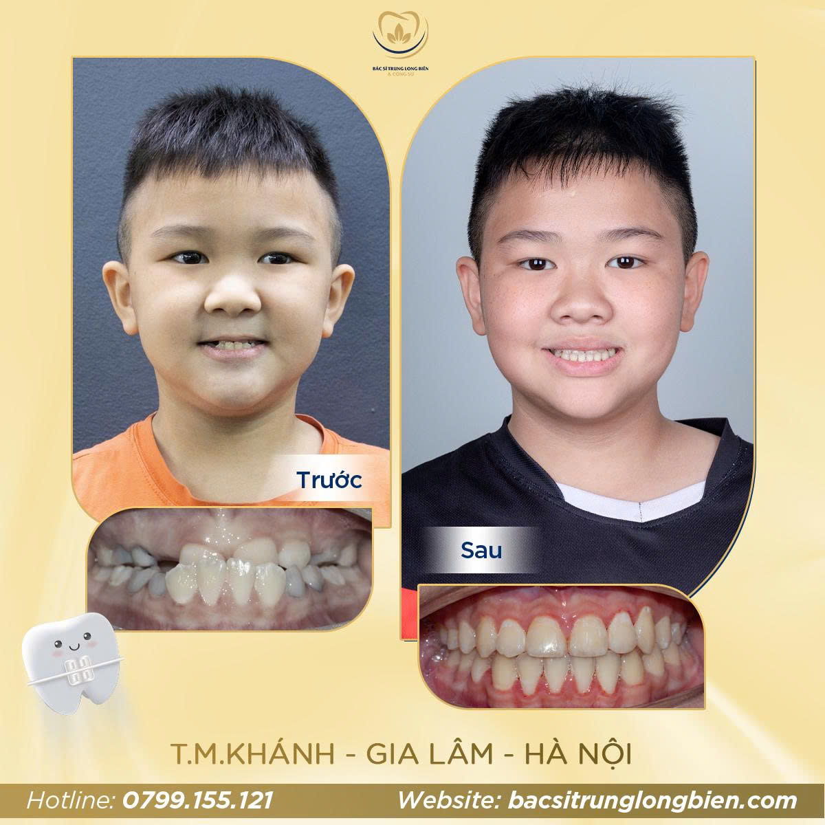 Khách Hàng T.M Khánh - Nha khoa Bác sĩ Trung Long Biên