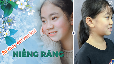 Video YouTube Hoang Oanh - Nha khoa Bác sĩ Trung Long Biên