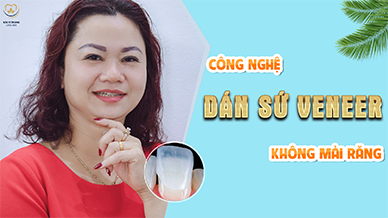 Video YouTube Khách hàng thu Hang - Nha khoa Bác sĩ Trung Long Biên