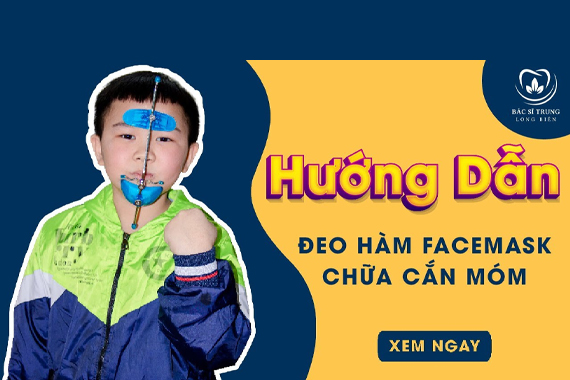 Khí cụ hàm Facemask là gì? Đối tượng nào có thể sử dụng?