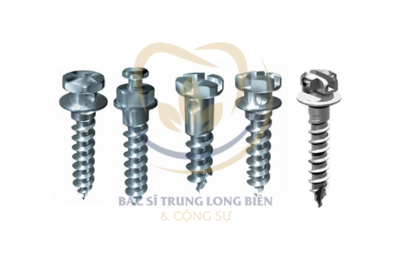 Trường hợp cần cắm Minivis - Trường hợp điển hình trong chỉnh nha