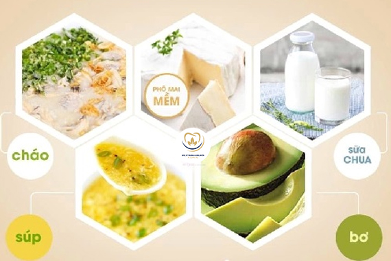 Người mới niềng răng nên ăn gì và không nên ăn gì?