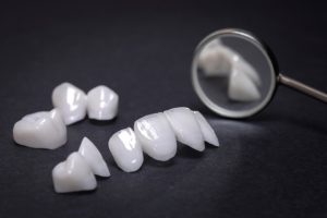 Quy trình làm răng sứ – Toàn cảnh của quy trình tại nha khoa bác sĩ Trung - Nha khoa Bác sĩ Trung Long Biên