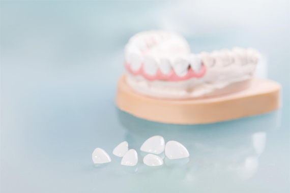 Những điều quan tâm nhất dành cho người muốn làm răng sứ - Nha khoa Bác sĩ Trung Long Biên