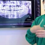 Câu chuyện khách hàng: nhổ răng khôn và lời khuyên đừng để qua tuổi 30