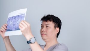 Bác sĩ đọc phim toàn hàm trước khi nhổ răng khôn tại Nha khoa Bác sĩ Trung Long Biên