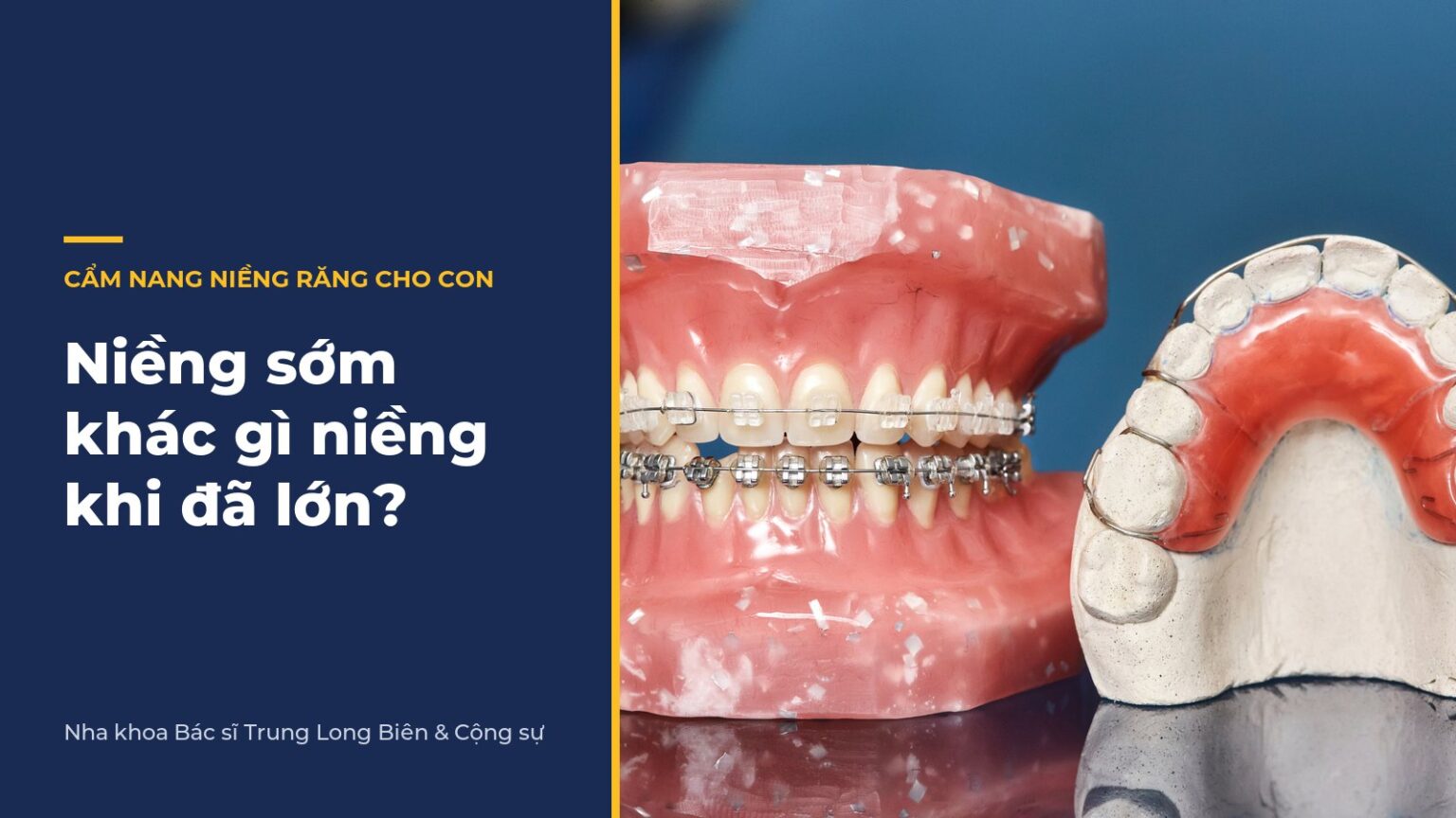 Niềng sớm khác niềng khi đã lớn thế nào? - Nha khoa Bác sĩ Trung Long Biên