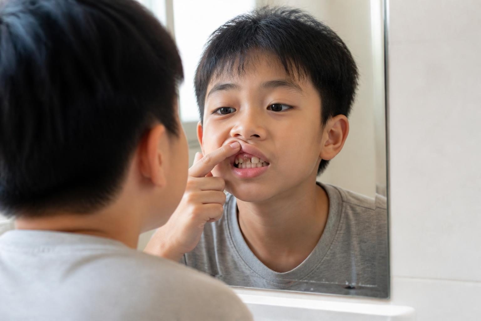 Bé trai soi gương xem răng cửa mọc lệch, dấu hiệu bố mẹ nên cho con đi khám niềng răng - ảnh minh hoạ