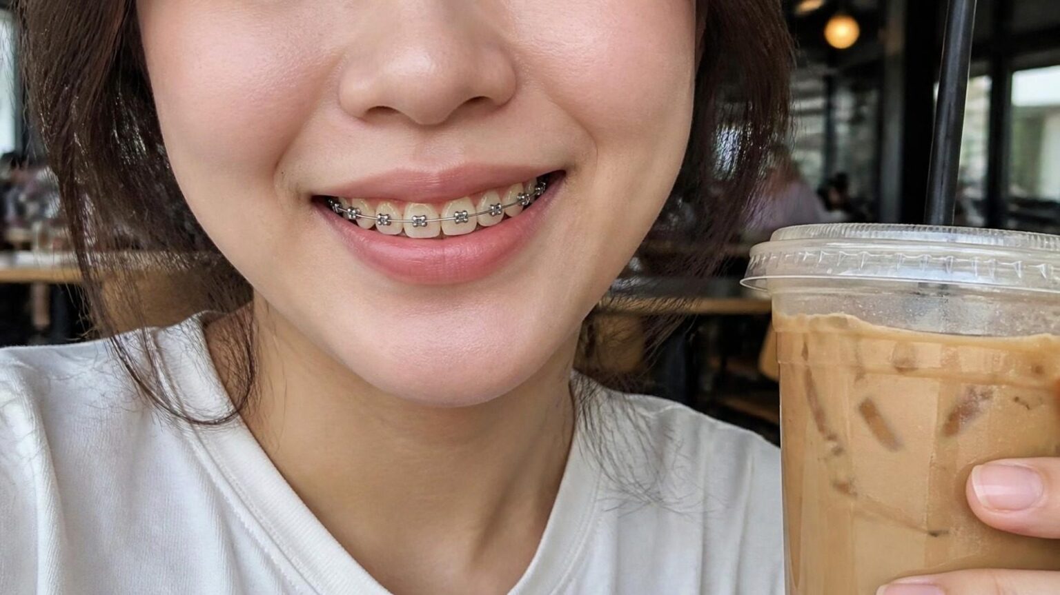 Nụ cười đang niềng răng mắc cài kim loại bên ly cà phê sữa - ảnh minh hoạ vàng răng khi niềng Nha khoa Bác sĩ Trung Long Biên